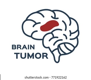 Brain Tumor